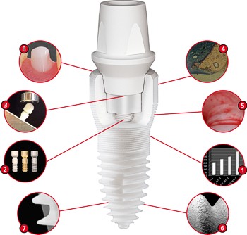 keramische Implantate Stuttgart | Implantologie Stuttgart | Zahnarzt Dr. med. dent. Reiner Grobler